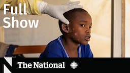 CBC News: The National | Mpox global health emergency