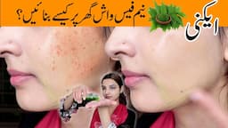 Homemade Neem Facewash Get Clear Acne Free Skin Permanently, Remove Pimples & Scars