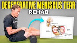 4 Rehab Exercises for a Degenerative Meniscus Tear