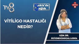 Vitiligo Hastalığı Nedir? | Uzm Dr. Egi Enkhjargal Losol | 8'de Sağlık