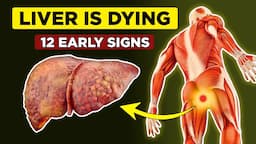 LIVER is DYING! 12 Weird Signs of Liver Damage | Foods to Clean Your Liver!