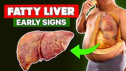 8 Signs You Have a FATTY LIVER | Healthify