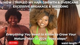 HOW TO GROW 4C NATURAL HAIR IN 2024| My Hair Journey: How I Overcame Balding+Damage & Tripled Growth