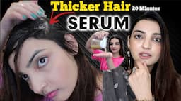 Thicker Hair Miracle Growth Serum - Treat Bald Patches, Thin Hair & Regrow Hair