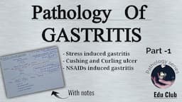 Gastritis | Acute Gastritis | Stress Ulcers | Cushing ulcer, Curling ulcer || GI Pathology