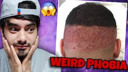 Most Weirdest Phobias that People actually have - part 2 😱