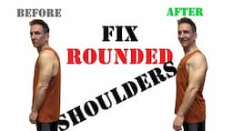 How To Fix Rounded Shoulders