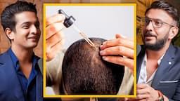 Think Twice Before Using Minoxidil & Finasteride For Hair Loss - Doctor Reveals Side Effects