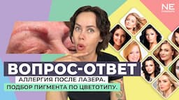 Аллергия после лазера. Подбор пигмента по цветотипу.