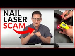 Nail Laser Scams: DIY - Home Fungus Toenail Lasers - Do They Really Work?