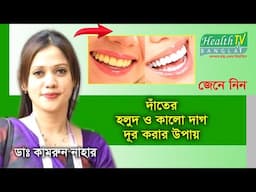 দাঁতের হলুদ ও কালো দাগ দূর করার উপায় | Yellow and Black Spots on Teeth | Health Tv Bangla