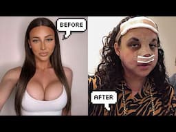 I AM ADDICTED TO PLASTIC SURGERY!