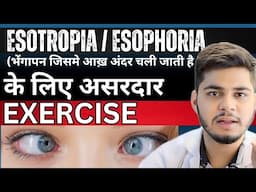 Best eye Exercise for Esotropia | Best eye exercise for squint Eye