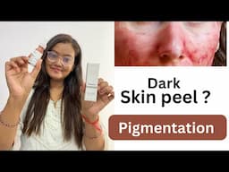 The ordinary peeling solution | क्या मेरी skin peel हुई 😲