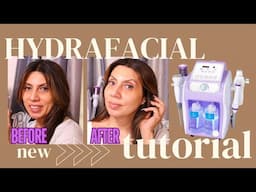 Honest Review | Mychway Hydro Dermabrasion Machine For Home Use Instant Glowing Skin [HYDRAFACIAL]