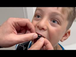 How to Pull a Loose Tooth 🦷 Losing a Baby Tooth 😁 Fun and Educational Vidoes for Kids