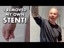 Removing My Own Ureteral Stent After Kidney Stone Surgery: The Painful Truth Revealed!