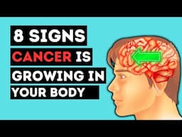 Don't Miss These 8 Early Cancer Signs – It Could Save You!