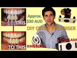 How To Make DIY Cross Polariser Filter At Home For Dental Photography (Ring Flash and Twin Flash)