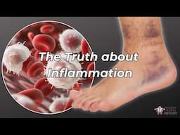 How Inflammation Really Works | Institute of Human Anatomy