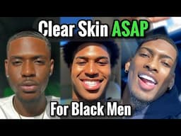 How to Get Clear Skin ASAP for Black Men