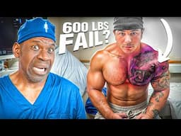 Is Tren Twins Pec Tear A CAREER ENDING Injury? | Surgeon Explains Manic Mike Bench Press Fail