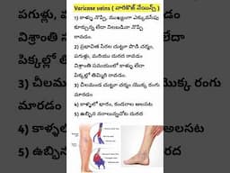 వేరికోసి్  వీన్స్  Varicose veins symptoms in Telugu #shorts #ytshorts #saanvidental #trendingshorts