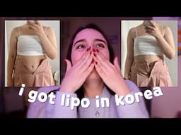 🇰🇷 my LAMS experience // procedure day, results, cost