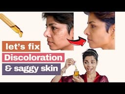 3 At Home Remedies to Correct DISCOLORATION n and Prevent Face from SAGGING