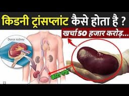 जानिए किडनी ट्रांसप्लांट कैसे होता है ? | How Kidney Transplant Is Done