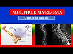 MULTIPLE MYELOMA  - Definition, types, causes, pathophysiology, signs & symptoms, medicine