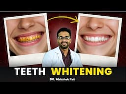 TOP 3 WAYS  TO WHITEN YOUR TEETH | दांत सफ़ेद कैसे करे