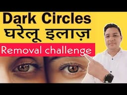 आँखों के अंदर धसने की best Therapy || Remove Dark Circles in 7 days.