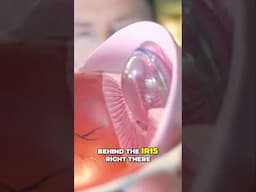 Understanding Cataract Surgery: The Importance of the Crystalline Lens