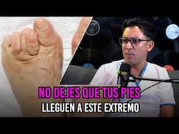 No dejes que tus pies lleguen a este extremo | Rayos X