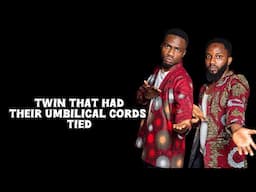 The Twin that had their umbilical cords tied together