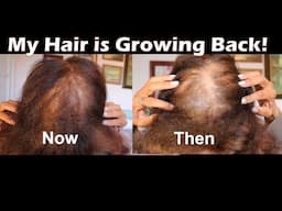 Hair Growth Treatment for Mature Women | Scienlodic SciVive Hair+ Pro