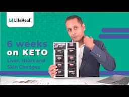 6 Weeks On Keto | Ketogenic Diet | Weightloss | Metabolic Health | Junior Gupta