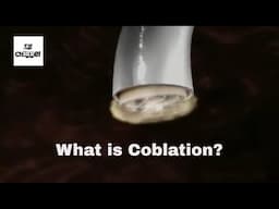 What is coblation?