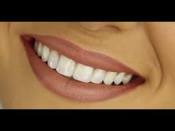 Dental implants and Hollywood smiles: Advances and pitfalls