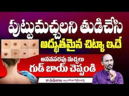 ఒంటిపై మచ్చలు పోవాలంటే | How To Reduce Moles | Dr.Madhubabu | Beauty Tips Telugu | Hi Tv Health