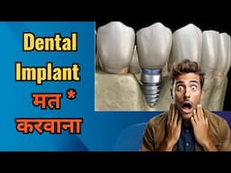 Say no to dental implant,if you have these conditions.