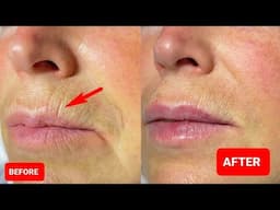 How to get Plump Lips, Fuller Lips and Bigger Lips, Reduce wrinkles around the lips