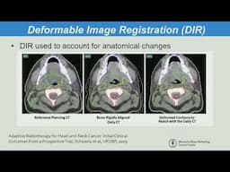 SRS/SBRT Treatment Fields: Image Regisration, Fusion Algorithm, and Dose Accumulation