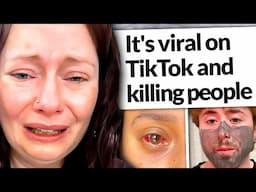 TikTok is making people crave these surgeries. They're losing their lives.