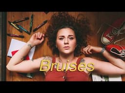 Bruises - Lewis Capaldi (Rearranged Cover by Elisa Spigariol)