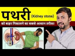 Pathri ko bahar nikalne ka Aasan tarika | pathri ka ilaj | kidney stone symptoms cause treatment