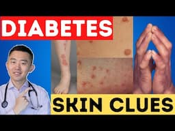 Top 8 Skin Warning Signs of Diabetes and Insulin Resistance