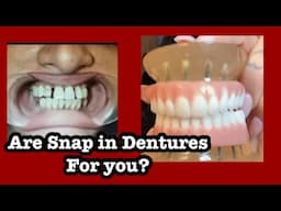 Questions about Snap in Dentures