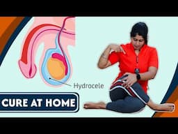 इन योग से ठीक होगा हाइड्रोसील घर बैठे | Best YOGA POSES to CURE Hydrocele at Home FAST | @Yogawale